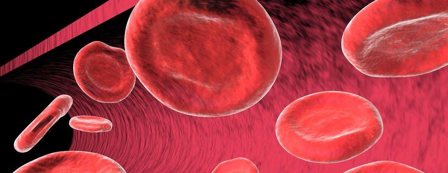 Natural Ways to Help Treat High Blood Pressure